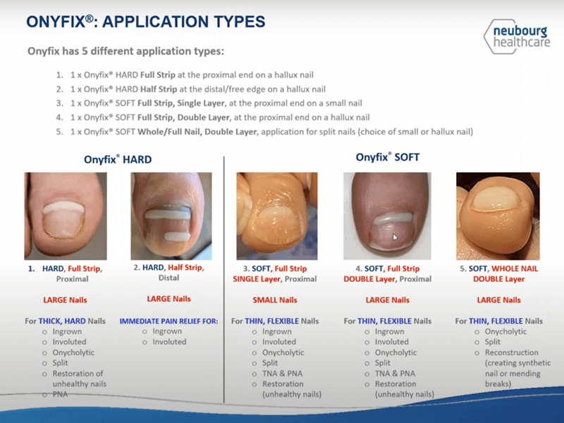 Ingrown Toenails | Foot & Podiatry Surgery