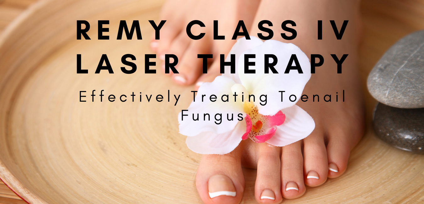 remi laser for fungus toenails
