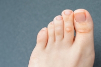 Various Treatment Methods For Broken Toes