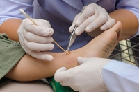 Causes and Treatment of Ankle Ulcers