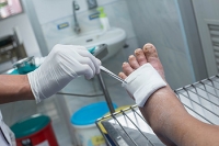 Types of Diabetic Foot Ulcers